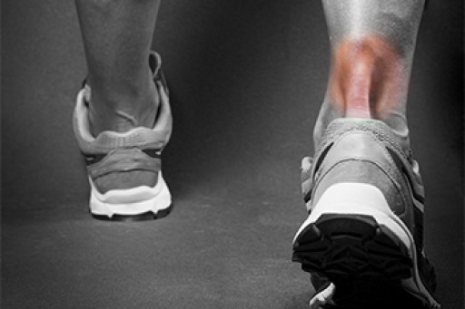 Achilles Tendon Injuries