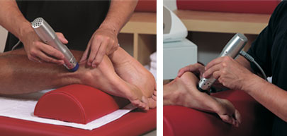 Radial Shockwave Therapy Procedure